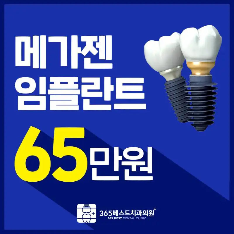 메가젠 임플란트