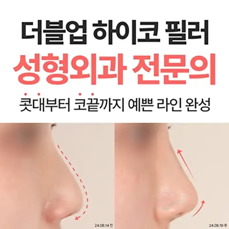더블업 하이코 필러 성형외과 전문의