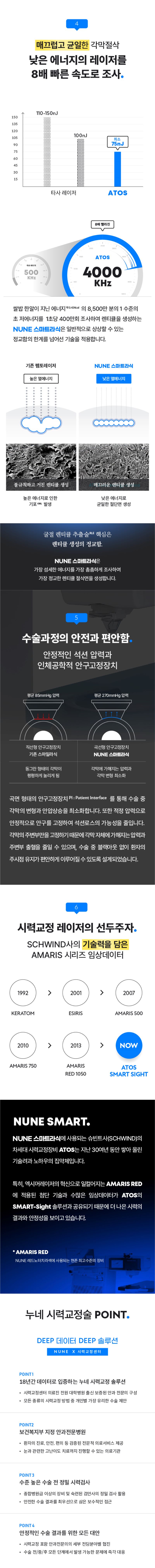 누네안과병원 스마일라식 그 이상, 스마트라식 이벤트, 시술 상세 이미지