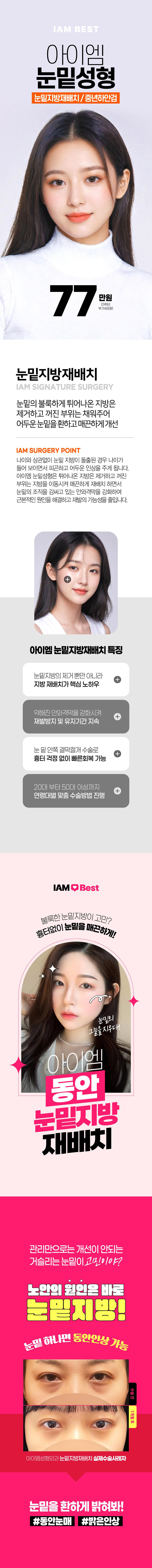 아이엠성형외과의원 부산_동안눈매완성 눈밑지방재배치 이벤트, 시술 상세 이미지