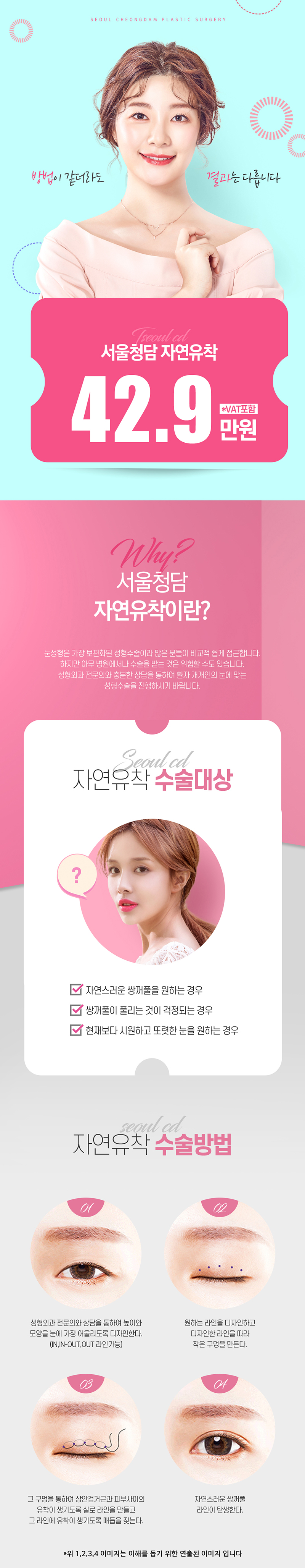 서울청담성형외과의원 부산 자연유착 이벤트, 시술 상세 이미지