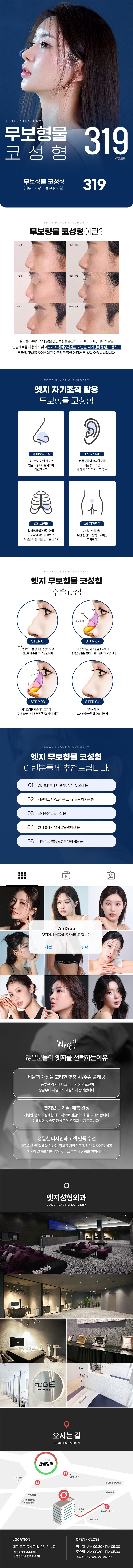 엣지성형외과 대구 엣지 무보형물 코성형 이벤트, 시술 상세 이미지