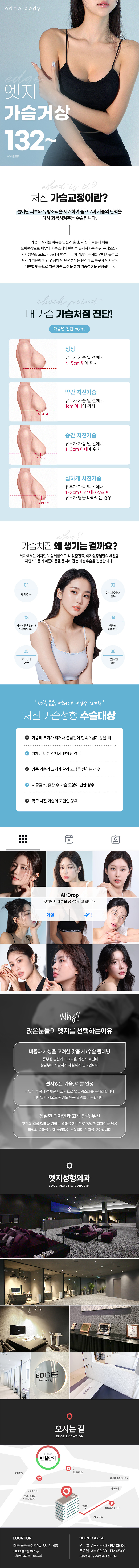 엣지성형외과 탄력있는 가슴라인 대구 엣지 가슴거상 이벤트, 시술 상세 이미지