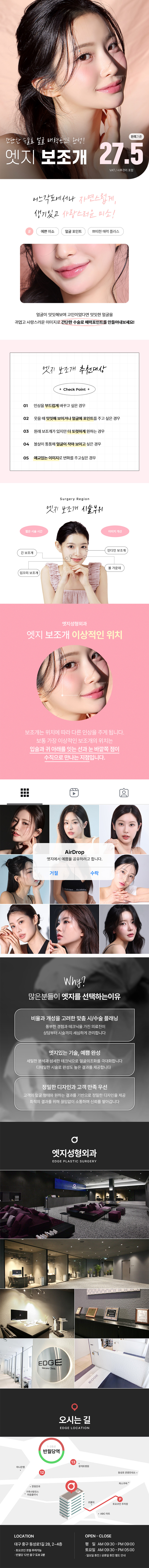 엣지성형외과 내 얼굴의 포인트, 대구 엣지 보조개 이벤트, 시술 상세 이미지