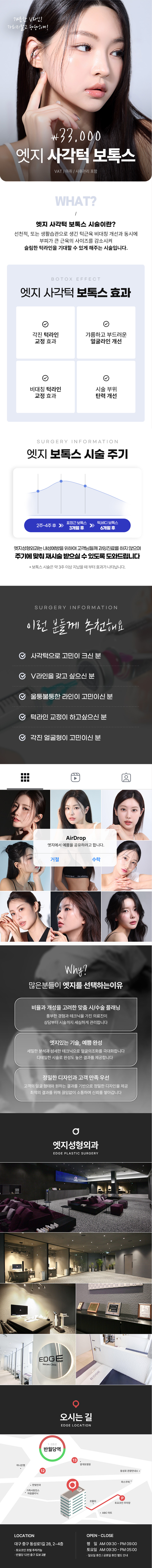 엣지성형외과 갸름한 V라인, 대구 사각턱보톡스 이벤트, 시술 상세 이미지