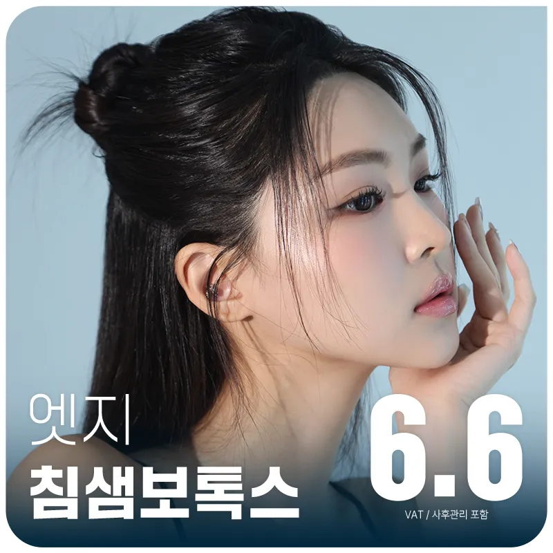 대구 엣지, 침샘 보톡스 이벤트 썸네일 이미지