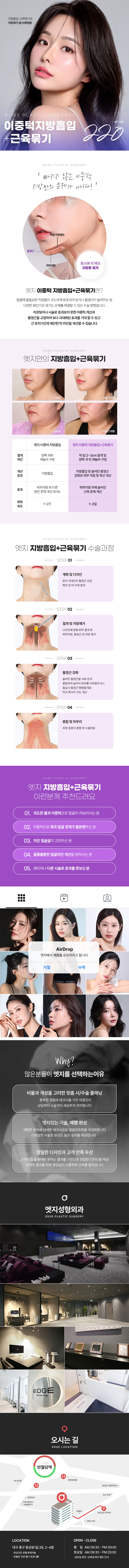 엣지성형외과 대구 엣지 이중턱근육묶기 이벤트, 시술 상세 이미지