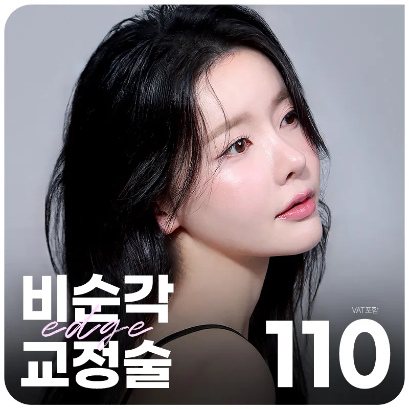 대구 엣지 비순각코성형 이벤트 썸네일 이미지