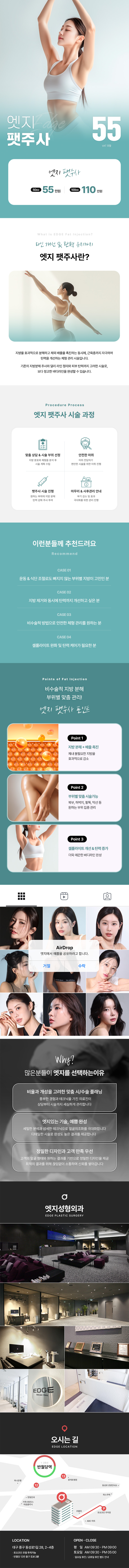 엣지성형외과 라인이 예뻐지는 대구팻주사 이벤트, 시술 상세 이미지