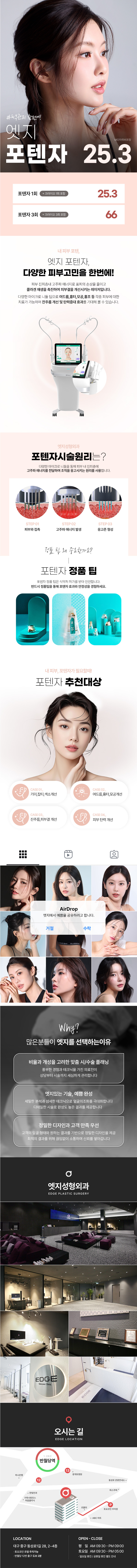 엣지성형외과 대구 엣지 피부관리, 포텐자 이벤트, 시술 상세 이미지