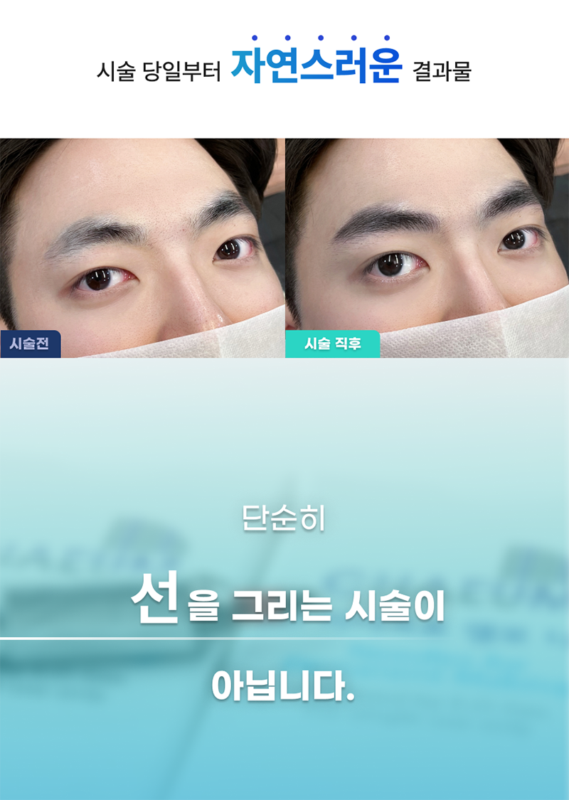 리앤채움의원 진짜 같은 남자눈썹문신_리터치 포함 이벤트, 시술 상세 이미지