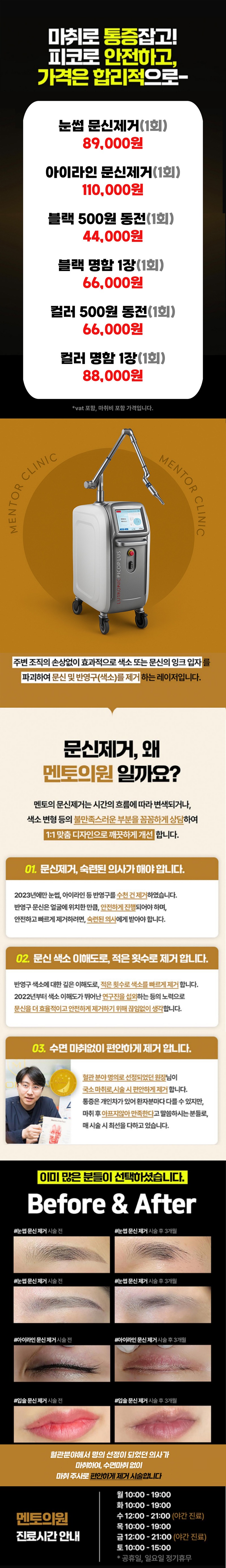 멘토의원 수면마취 없이 편안한 눈썹,아이라인제 이벤트, 시술 상세 이미지