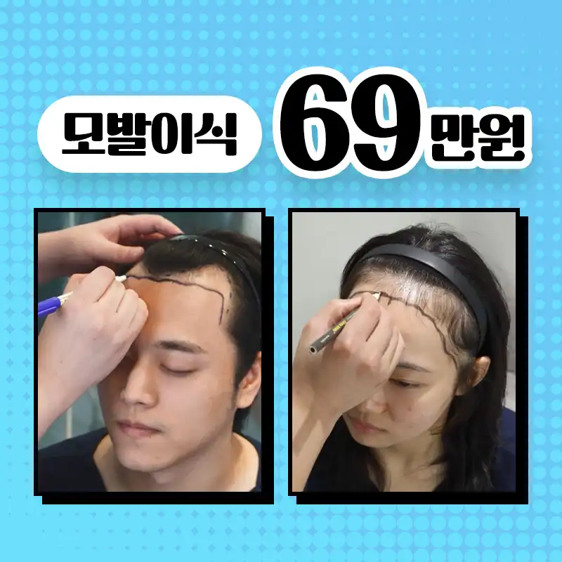 [수도권특집] 모발이식 69만원