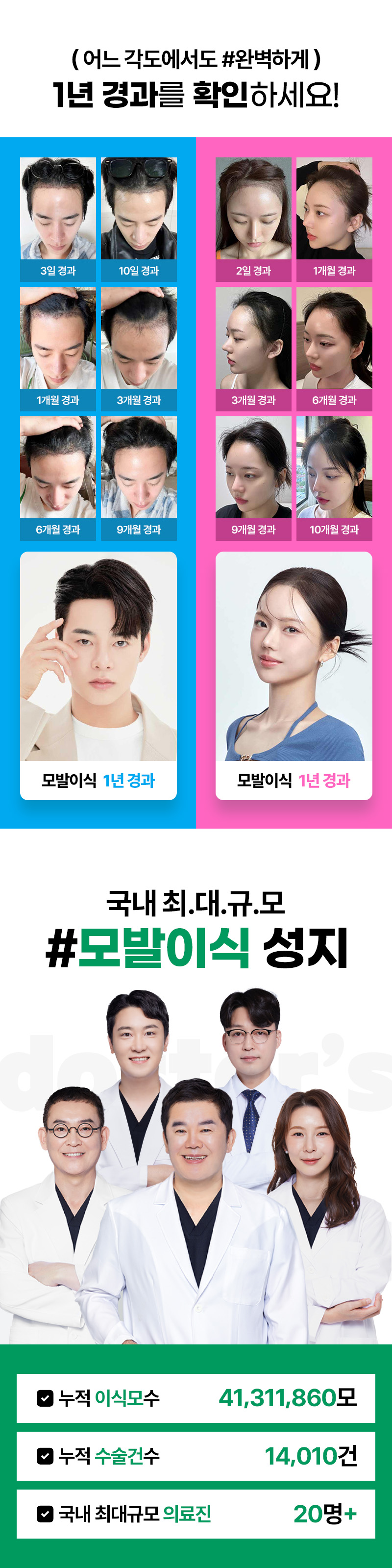 모모의원 부산점 [부산특집] 모발이식 75만원 이벤트, 시술 상세 이미지