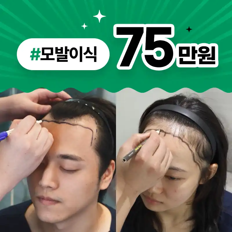 [부산특집] 모발이식 75만원
