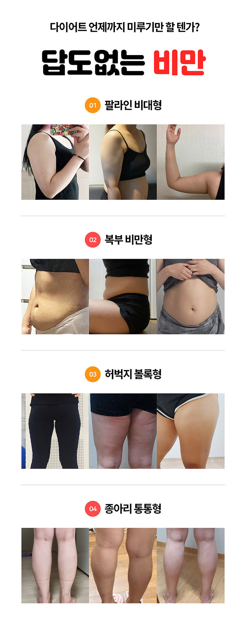 상상의원 대구점 [대구특집] 지방분해주사 특별 혜택 이벤트, 시술 상세 이미지