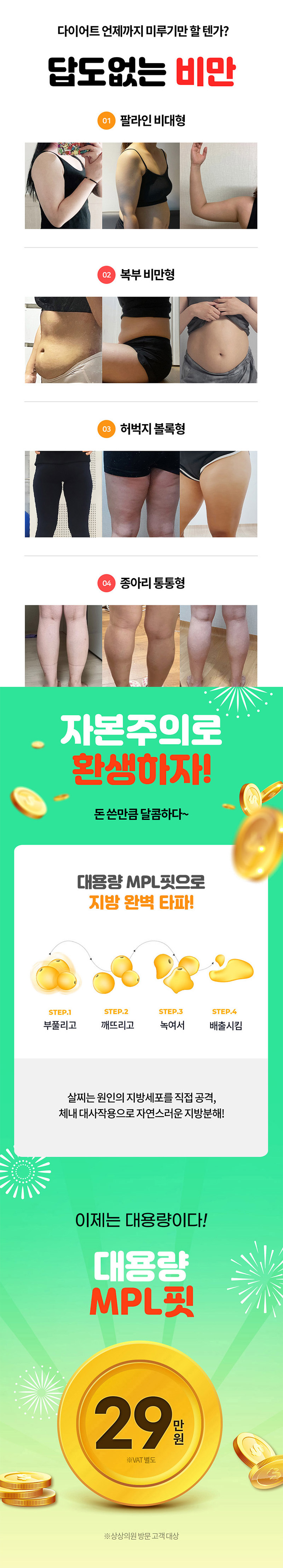 상상의원 대전점 [대전특집] 지방분해주사 특별 혜택 이벤트, 시술 상세 이미지