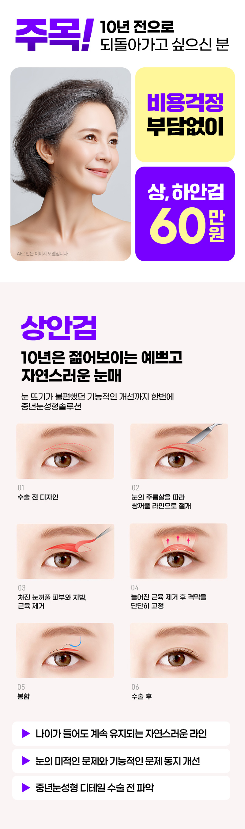한나이브성형외과의원 [안양특집] 상,하안검 필요하신 분! 이벤트, 시술 상세 이미지