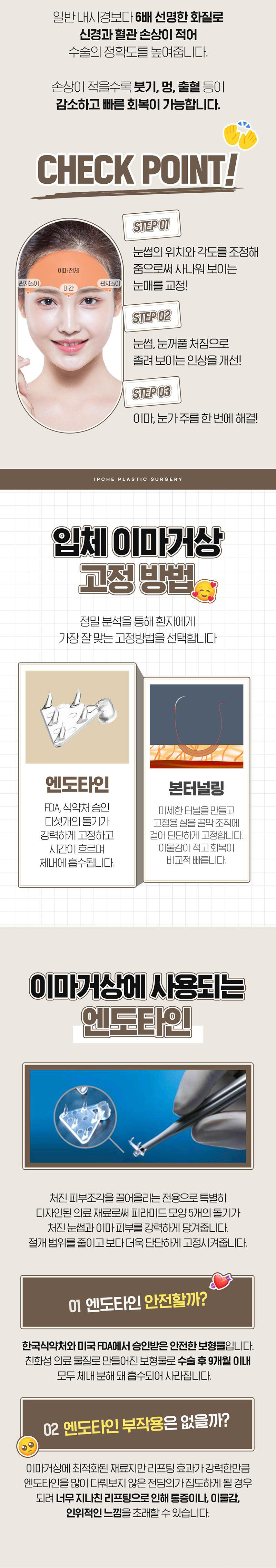 입체성형외과의원 입체 내시경 이마거상 이벤트, 시술 상세 이미지