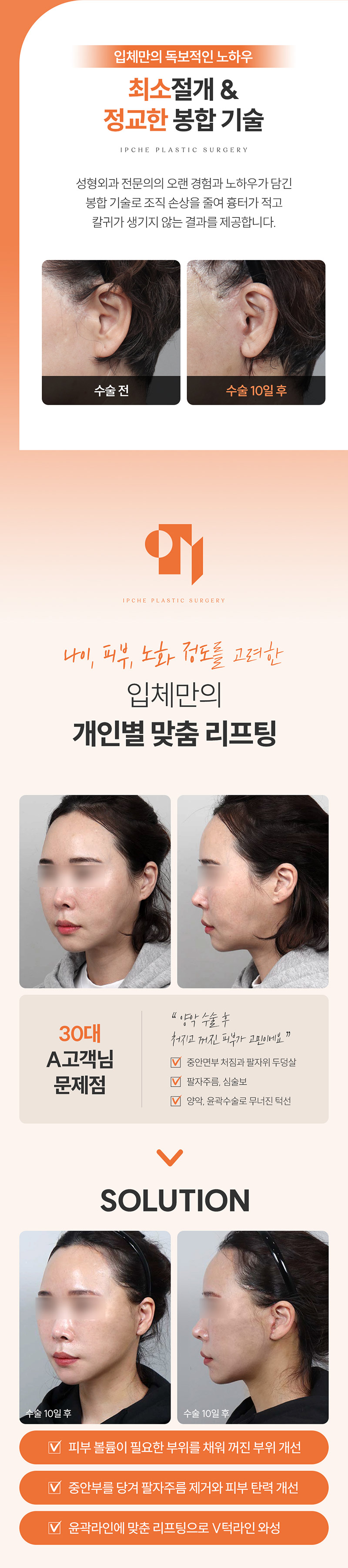 입체성형외과의원 입체 SMAS 안면거상 이벤트, 시술 상세 이미지