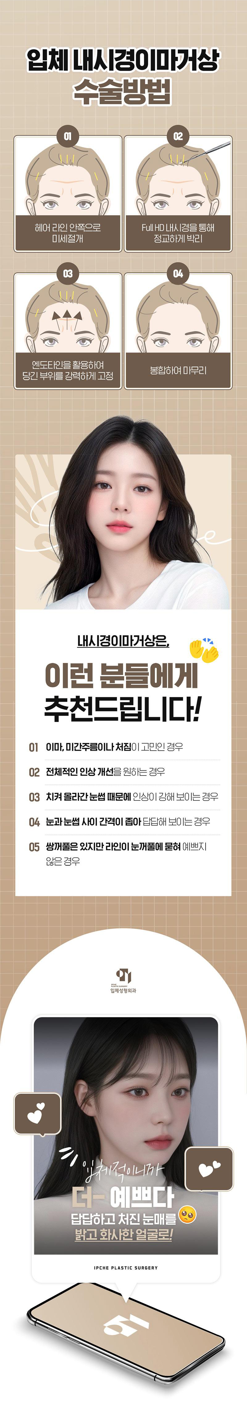 입체성형외과의원 입체 내시경 이마거상 이벤트, 시술 상세 이미지