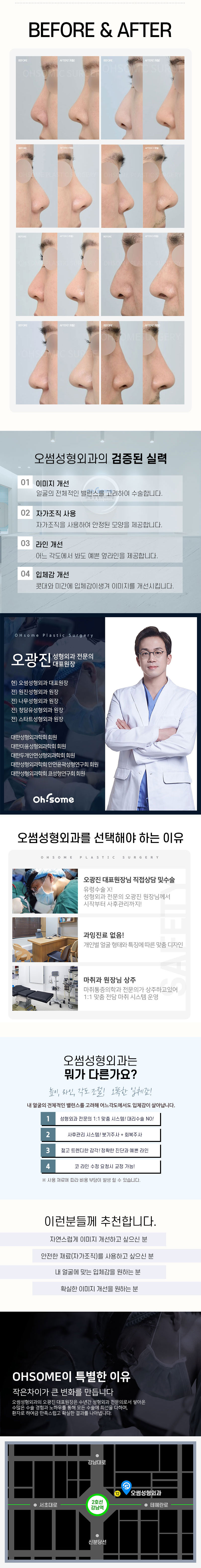오썸성형외과 오썸 비개방 콧대코끝성형 이벤트, 시술 상세 이미지