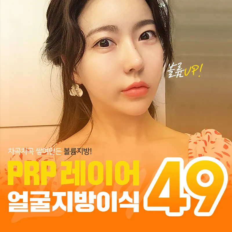 [서울/청담] PRP레이어 지방이식 이벤트 썸네일 이미지