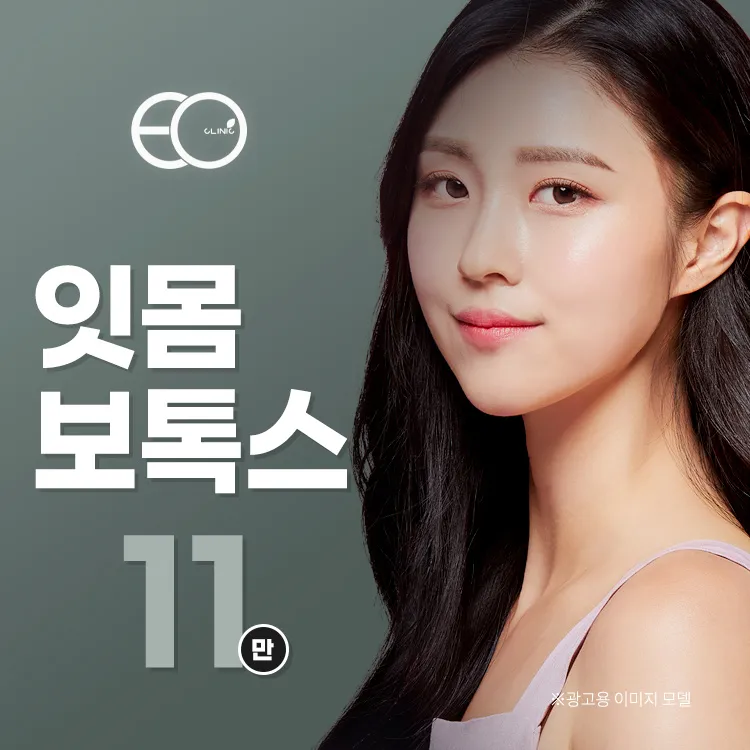 거미스마일 잇몸보톡스 이벤트 썸네일 이미지
