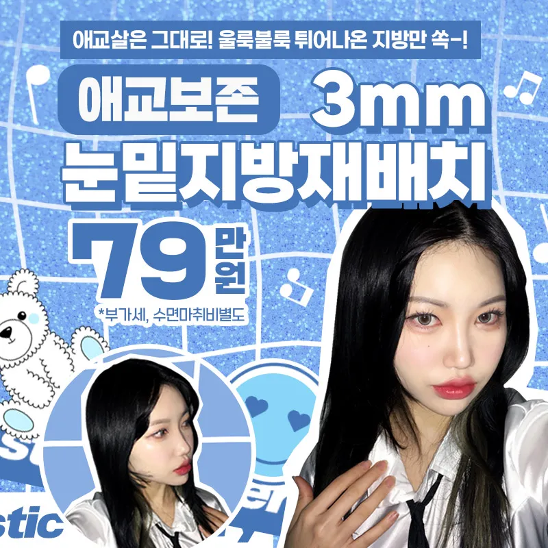 애교보존 3mms눈밑지방재배치 이벤트 썸네일 이미지