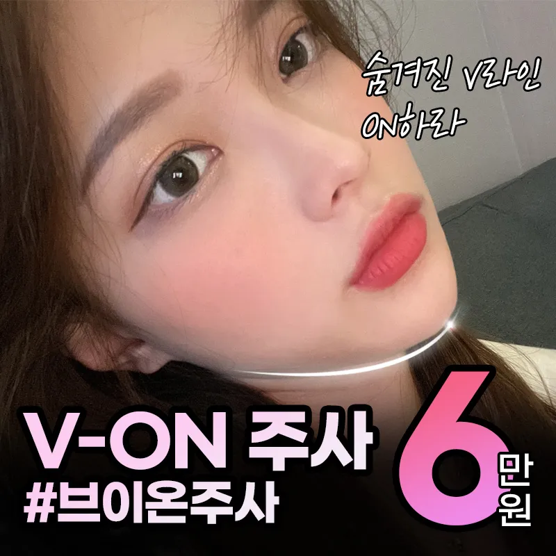 브이온 주사_윤곽주사 이벤트 썸네일 이미지