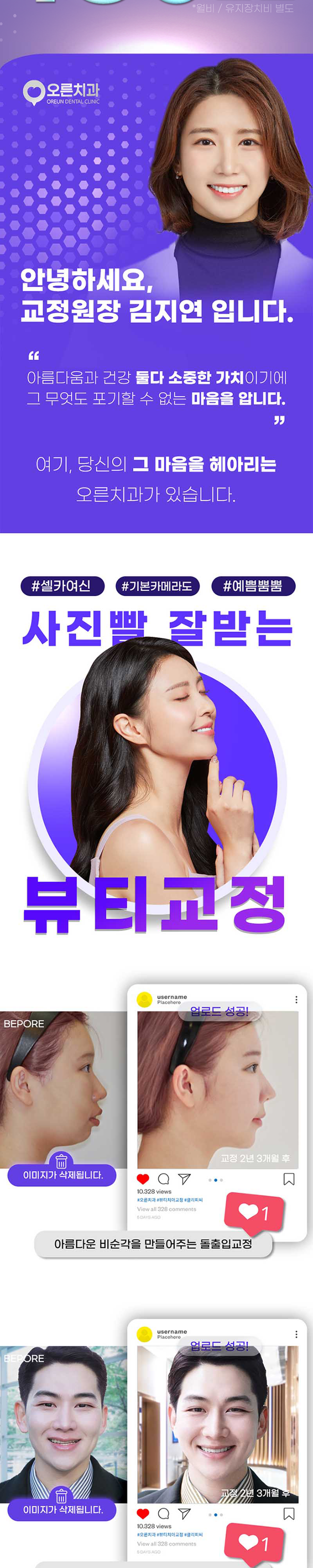 오른치과의원 비대칭잡는 동안뷰티 치아교정 클리피씨 이벤트, 시술 상세 이미지