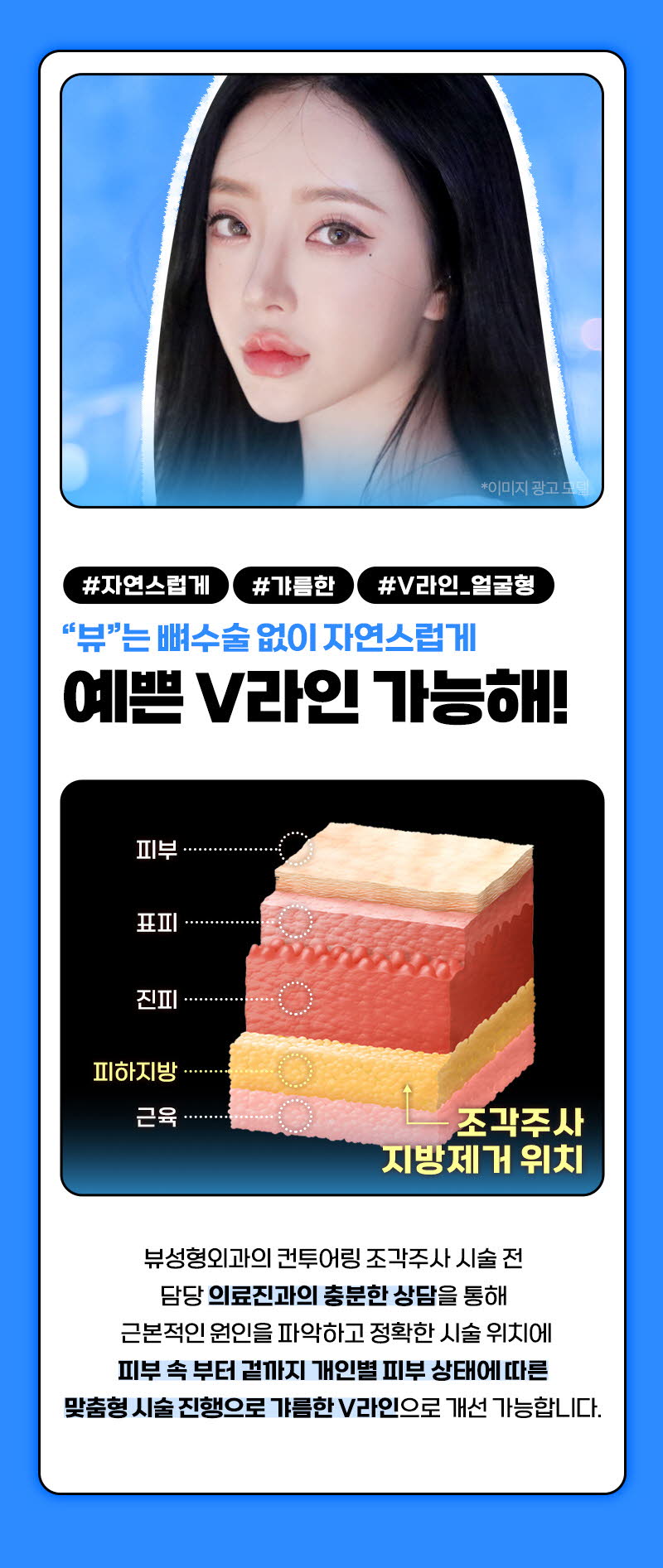 뷰성형외과 ❤뷰❤윤곽주사 이벤트, 시술 상세 이미지