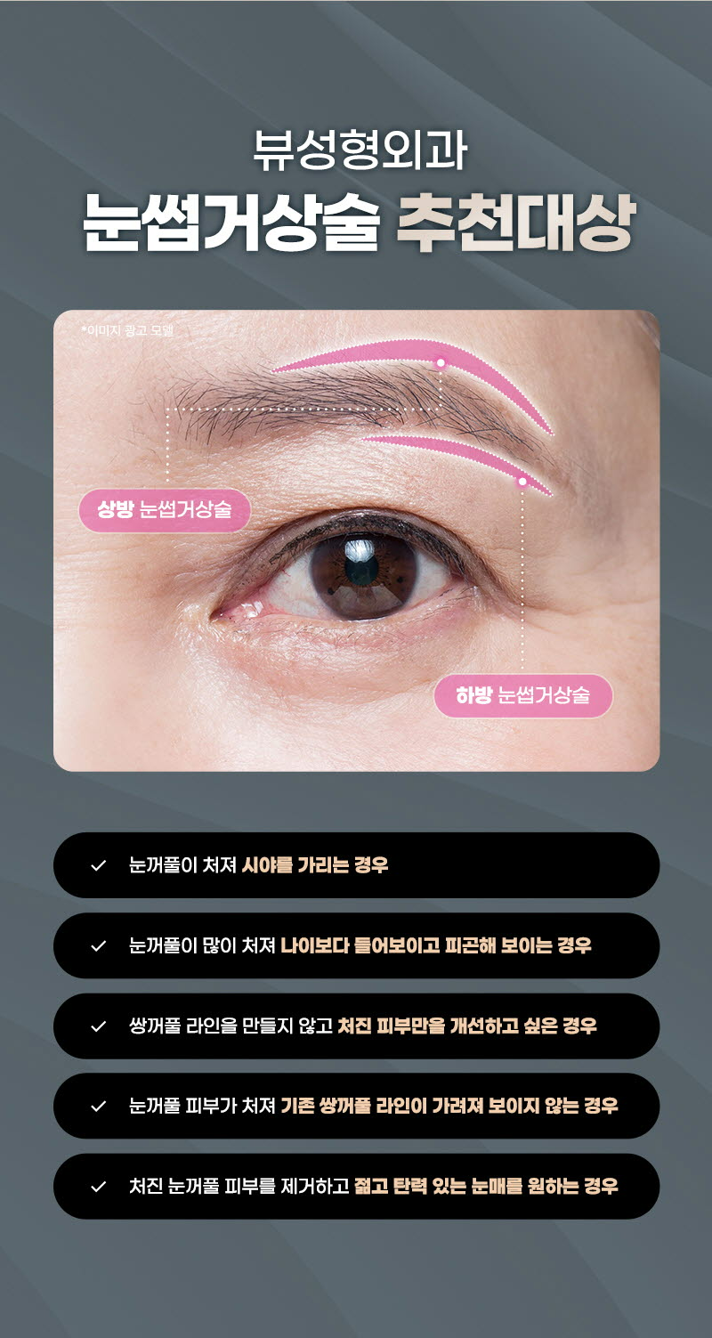 뷰성형외과 ❤️뷰❤️눈썹거상술 이벤트, 시술 상세 이미지