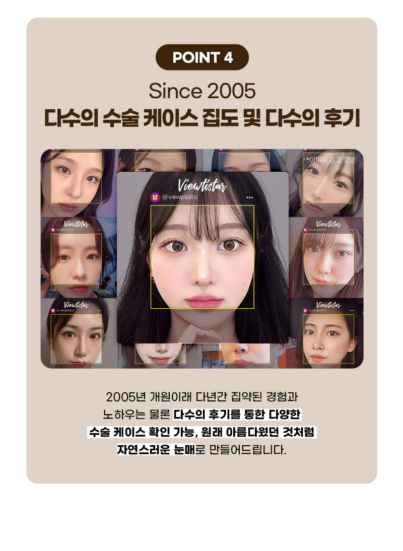 뷰성형외과 ❤️뷰❤️눈썹거상술 이벤트, 시술 상세 이미지