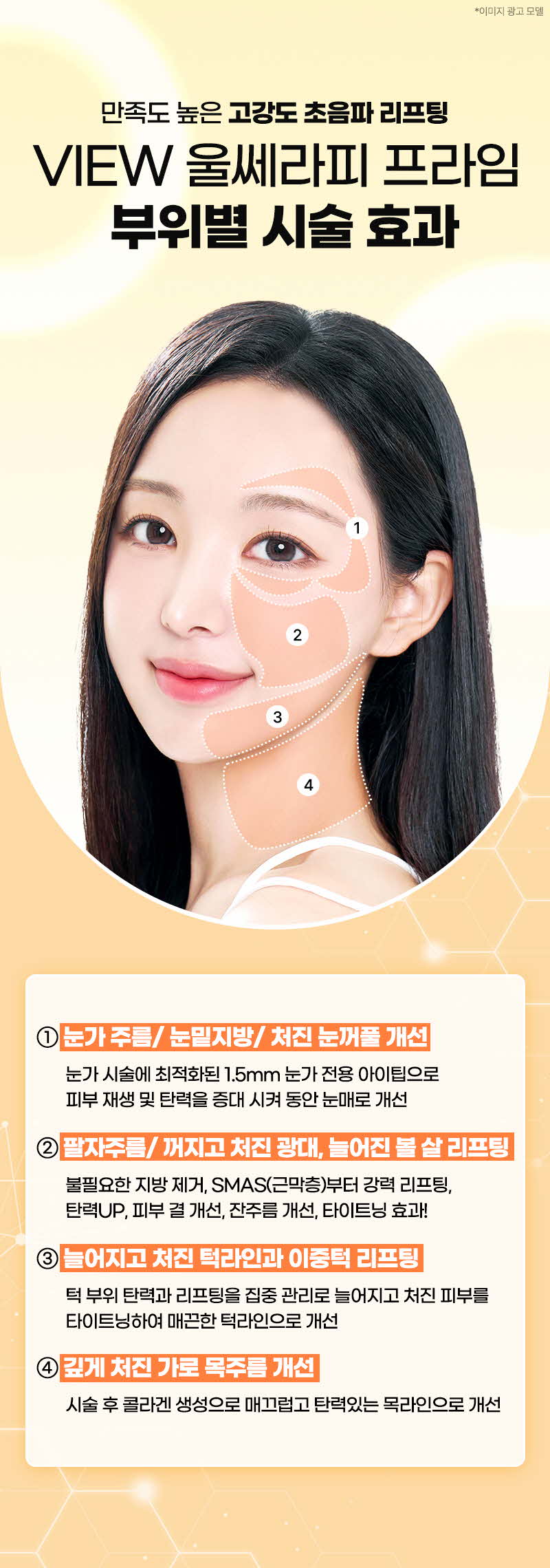 뷰성형외과 ❤뷰❤울쎄라피 프라임 이벤트, 시술 상세 이미지