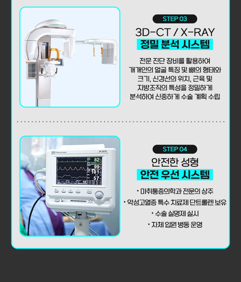 뷰성형외과 ❤️뷰❤️안면윤곽 이벤트, 시술 상세 이미지