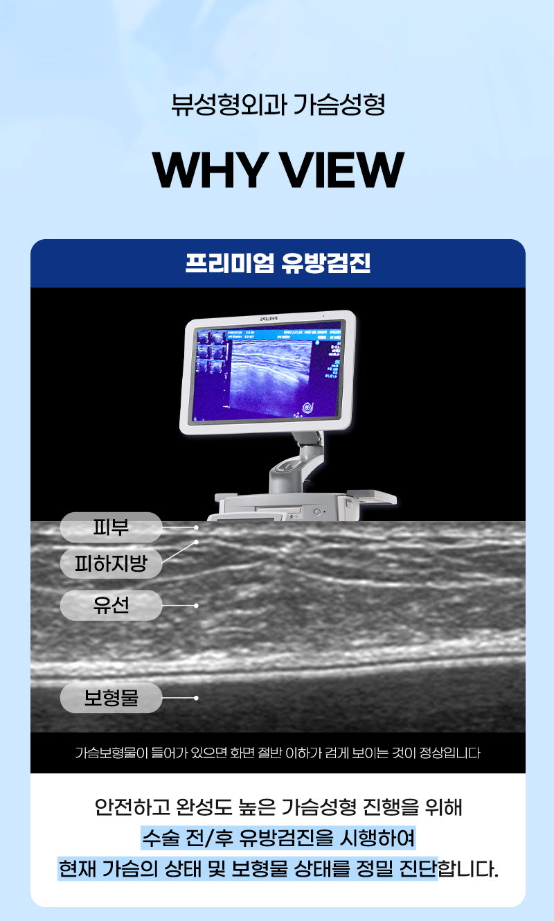 뷰성형외과 ❤️뷰❤️멘토 가슴성형 이벤트, 시술 상세 이미지