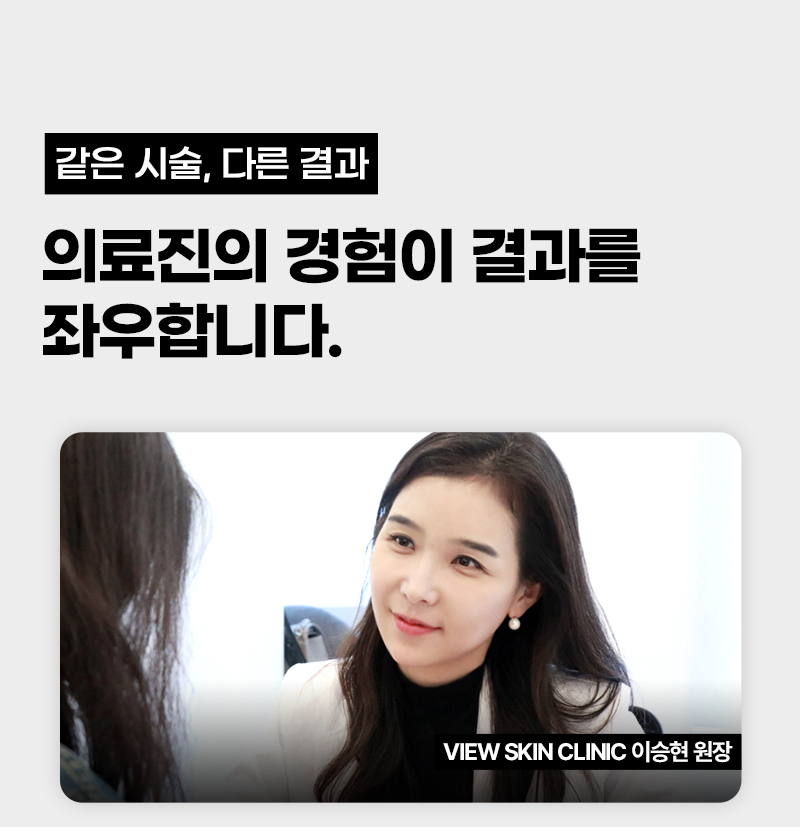 뷰성형외과 ❤️뷰❤️ 아이리프팅 이벤트, 시술 상세 이미지