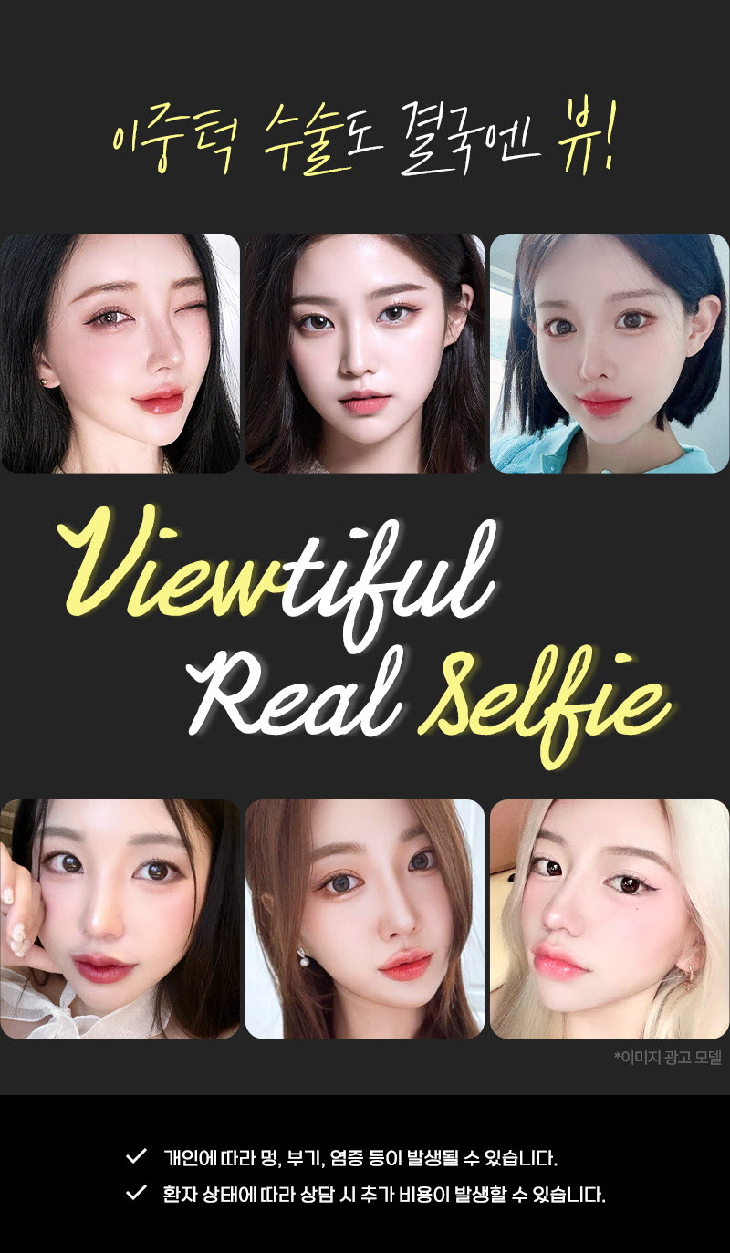 뷰성형외과 ❤뷰❤얼굴 지방흡입 이벤트, 시술 상세 이미지