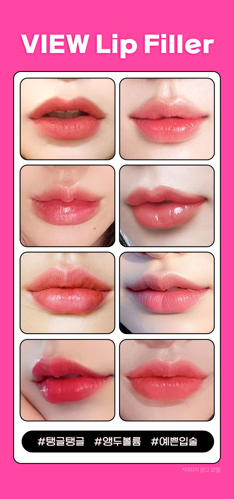 뷰성형외과 ❤뷰❤입술필러 이벤트, 시술 상세 이미지