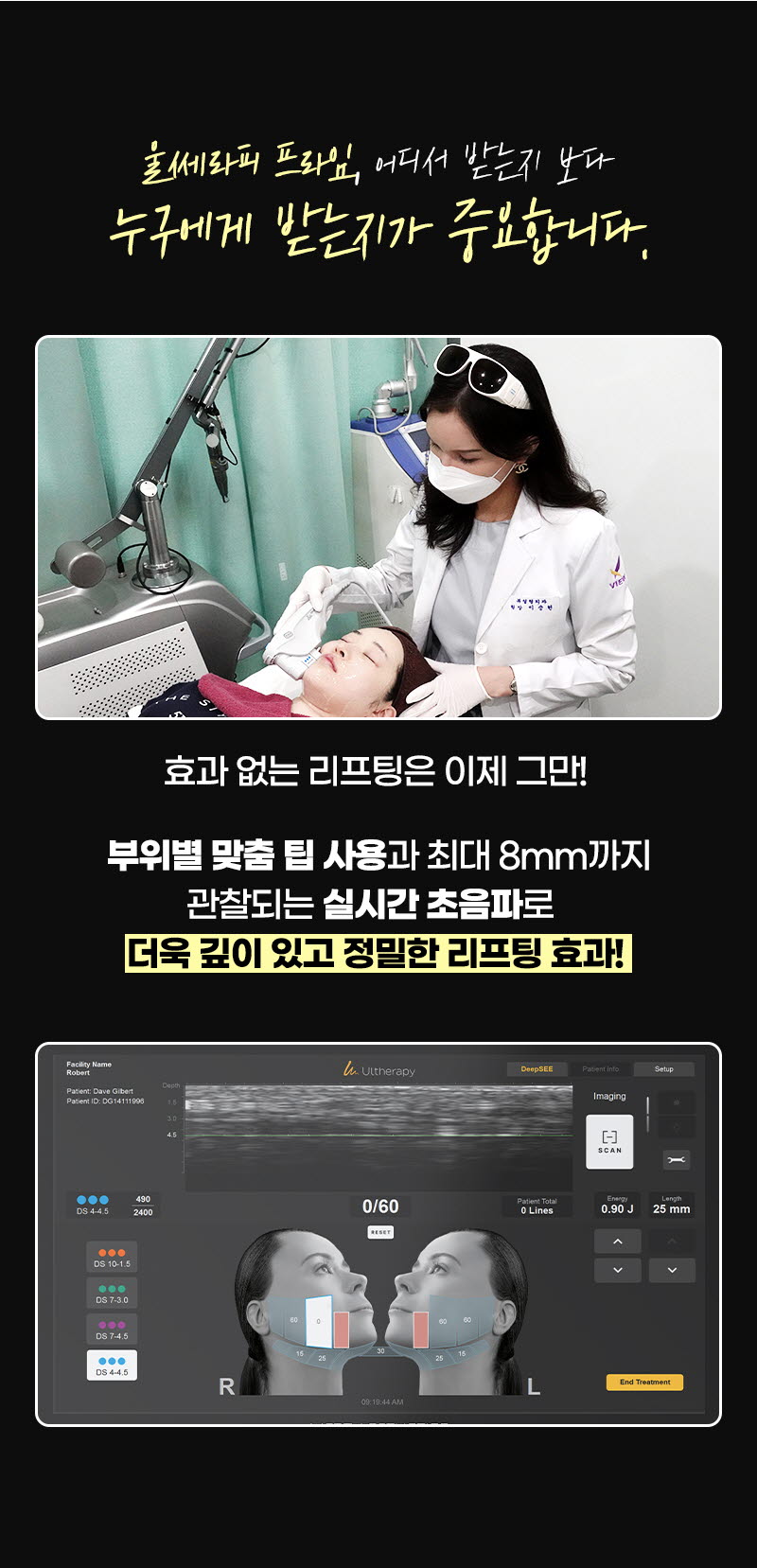 뷰성형외과 ❤뷰❤울쎄라피 프라임 이벤트, 시술 상세 이미지