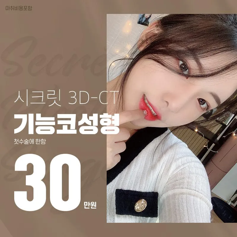 ✔ 3D-CT 기능코성형 이벤트 썸네일 이미지