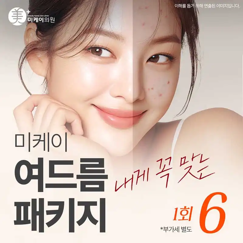 미케이 내게 꼭 맞는 여드름피부 관리