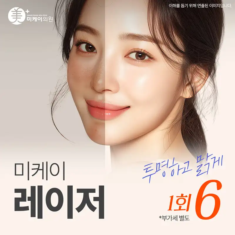 미케이 자국 지우개_레이저토닝