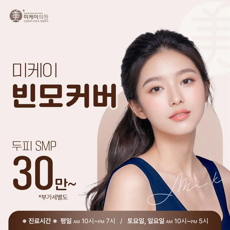 미케이 두피SMP 헤어라인반영구 이벤트 썸네일 이미지