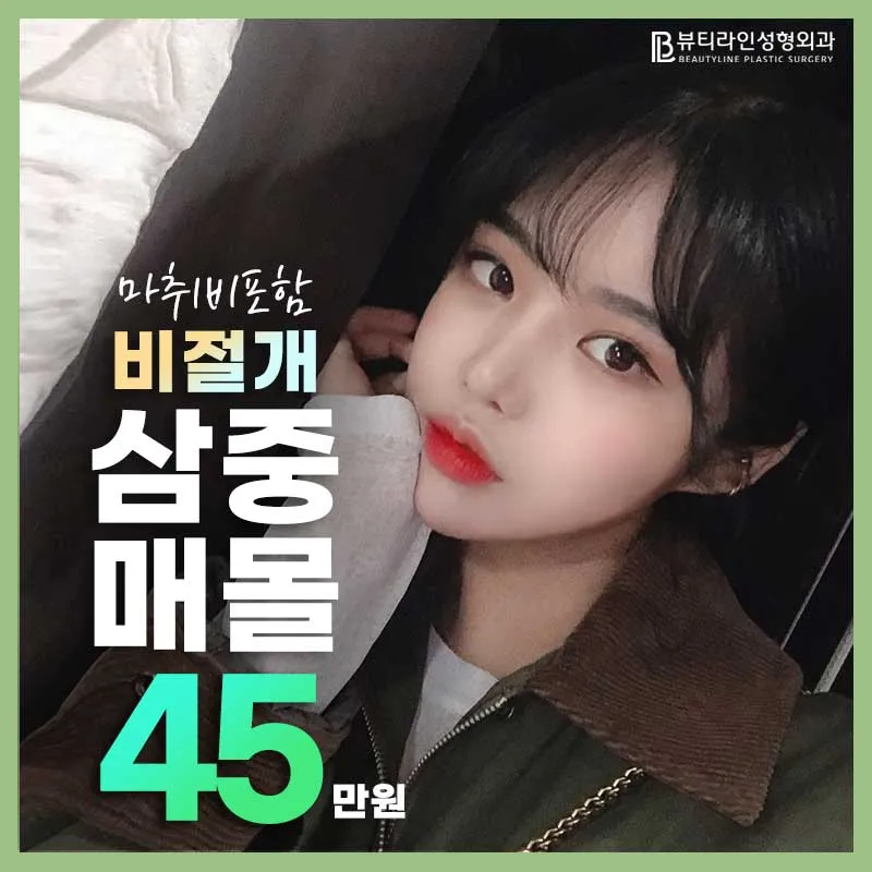 ⭐삼중매몰 쌍꺼풀 45⭐ 이벤트 썸네일 이미지