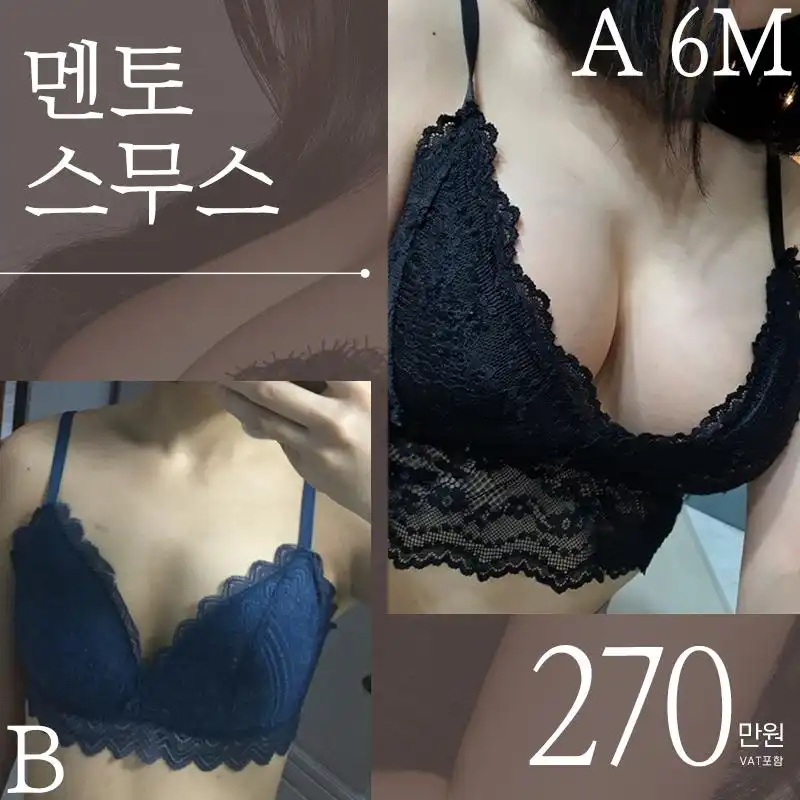 ♥멘토스무스 가슴성형♥