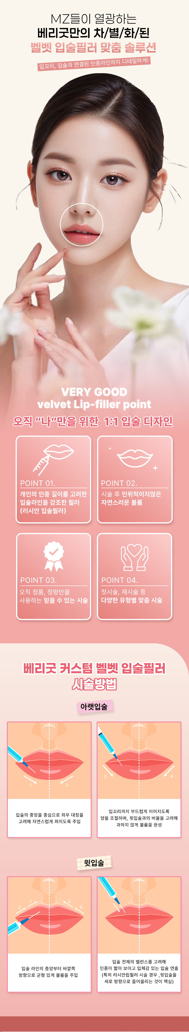 베리굿성형외과의원 베리굿 커스텀 벨벳 입술필러 이벤트, 시술 상세 이미지