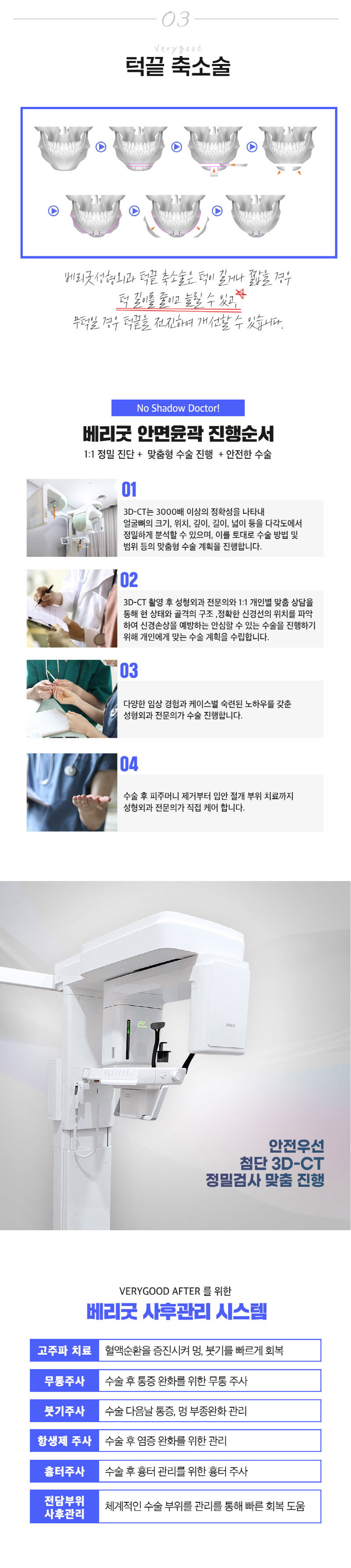 베리굿성형외과의원 베리굿♡추가금없는 안면윤곽 이벤트, 시술 상세 이미지