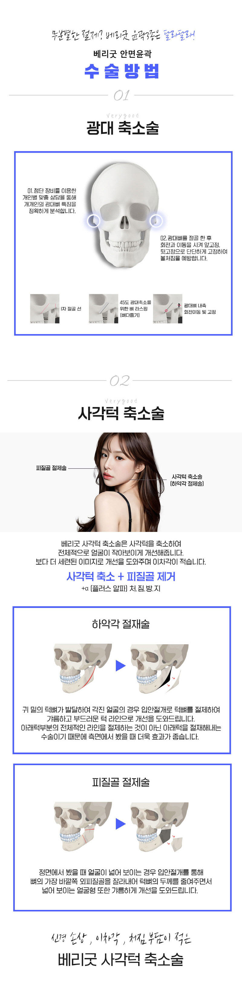 베리굿성형외과의원 베리굿♡추가금없는 안면윤곽 이벤트, 시술 상세 이미지
